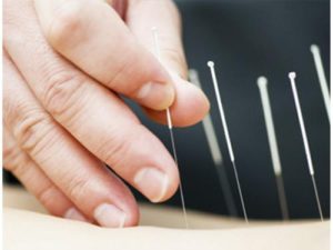 praktijk-hoograven-utrecht-acupunctuur