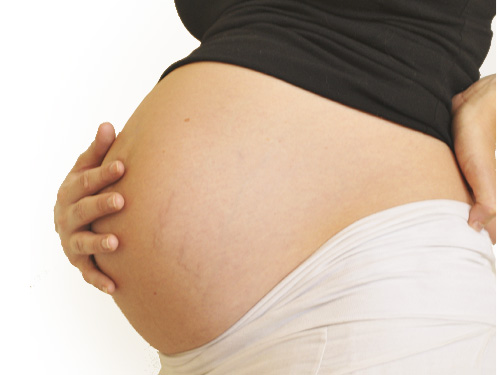 Zwangerschap, bevalling & postpartum